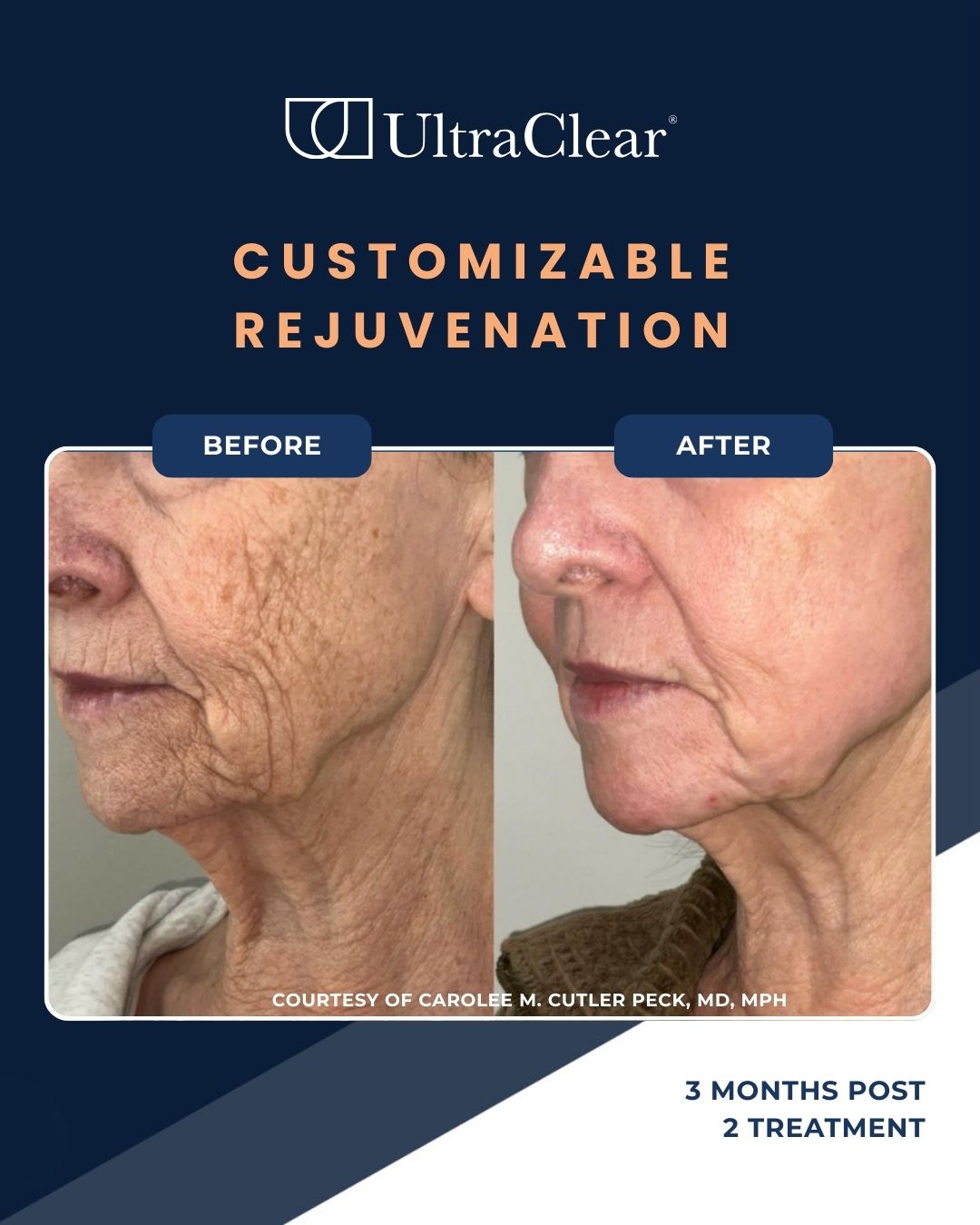 UltraClear at KinDRed Clinic